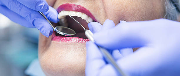 Best Emergency Broken Tooth Repair in Ferriday, LA